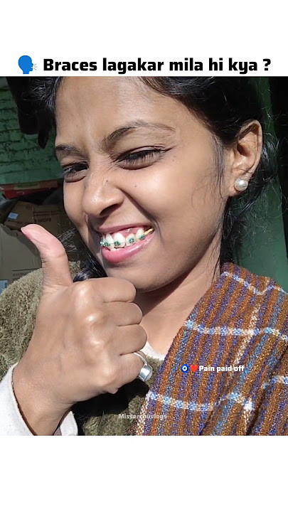 💀🔥Braces Transformation || I love this Smile 🧿🤭 #ytshorts #shorts #braces