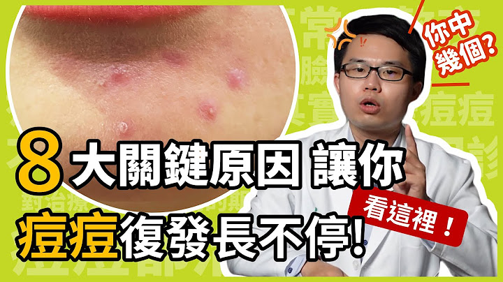 8大关键原因，让你痘痘复发长不停！皮肤科杨省三医师点出青春痘的治疗重点！ - 天天要闻