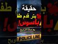 حقيقة بتر قدم طفل باسوس بعد صلاة التراويح في القليوبية تفاصيل الحادث ورد وزارة الصحة