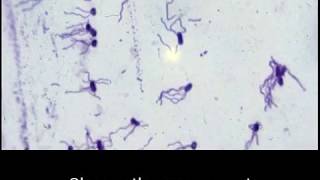 Structural stains: Endospore, capsule and flagella