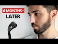 Beard roller before  after  6 month update