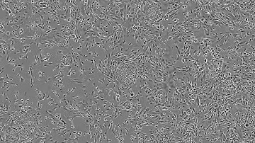 Reprogramming Human Fibroblasts to iPSCs