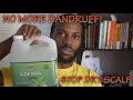 3 WAYS TO STOP DANDRUFF &amp; DRY SCALP | EASY!