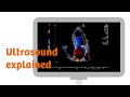 Ultrasound explained: how does it work? Mp3 Song