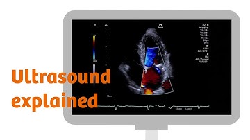 Ultrasound explained: how does it work?