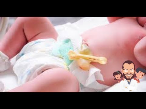 ميعاد سقوط سرة البيبي