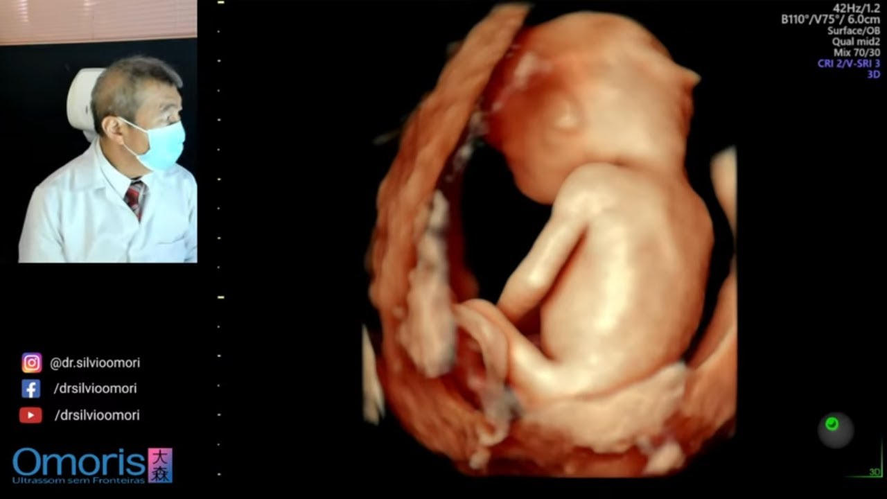 Gravidez 14 semanas !