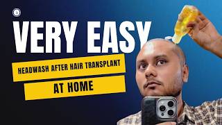 First Headwash After Hair Transplant 😳 | Safe At-Home Method | Bangladesh
