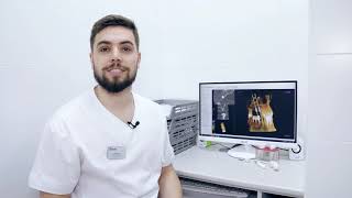 Имплантаты 