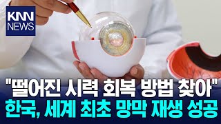 “떨어진 시력도 회복” 한국 연구진, 세계 최초로 망막 재생 기술 개발 / KNN