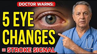 Doctor WARNS: 5 Eye Changes After 65 That Signal a Stroke Is Coming |  Senior Health Tips