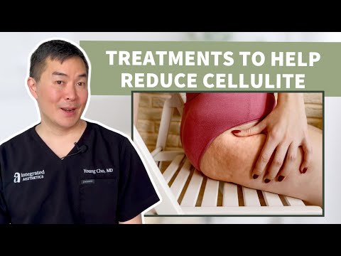 Discover Effective Cellulite Treatments with Dr. Young Cho at Integrated Aesthetics