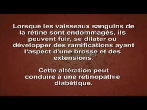 Causes et symptomes d&rsquo;une rétinopathie diabétique