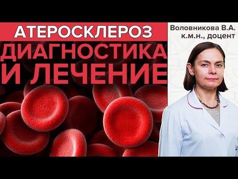 АТЕРОСКЛЕРОЗ | Диагностика и лечение атеросклероза