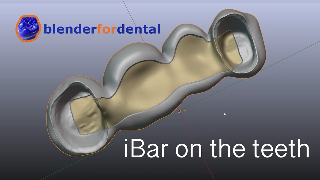 iBar на зубах за 5 хвилин: як зробити в Blender4Dental - Tutorial(ENG Subs)!