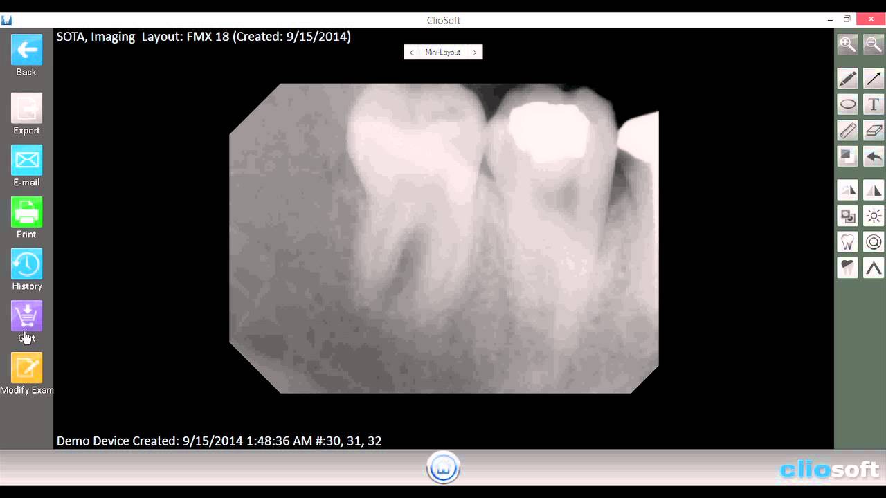 Cliosoft Dental Imaging Software Tutorial: Using the Imaging Cart