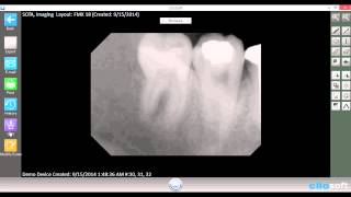 Cliosoft Dental Imaging Software Tutorial: Using the Imaging Cart screenshot 3