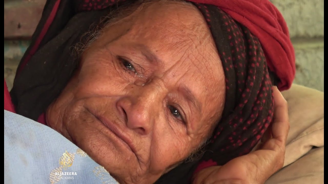 لقطات مروعة من اليمن: المجاعة تهدد الملايين