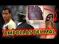 Las AMPOLLAS De Giovani DOS SANTOS