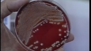 Scientists use genetics to combat superbugs