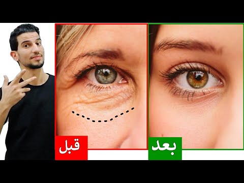 فيديو: 5 طرق بسيطة لعلاج تجاعيد العين