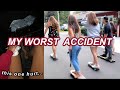 my worst longboarding accident...