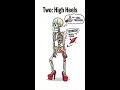 3 SHOES THAT CAUSE BACK PAIN AND SCIATICA!  #physiotherapist #animation #physiotherapy #sciatica