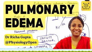 Pulmonary edema medicine lecture pathophysiology | Respiratory system