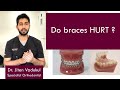 Do braces HURT ?  |  Dr. Jiten Vadukul  |  The Orthodontist