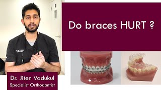 Do braces HURT ?  |  Dr. Jiten Vadukul  |  The Orthodontist