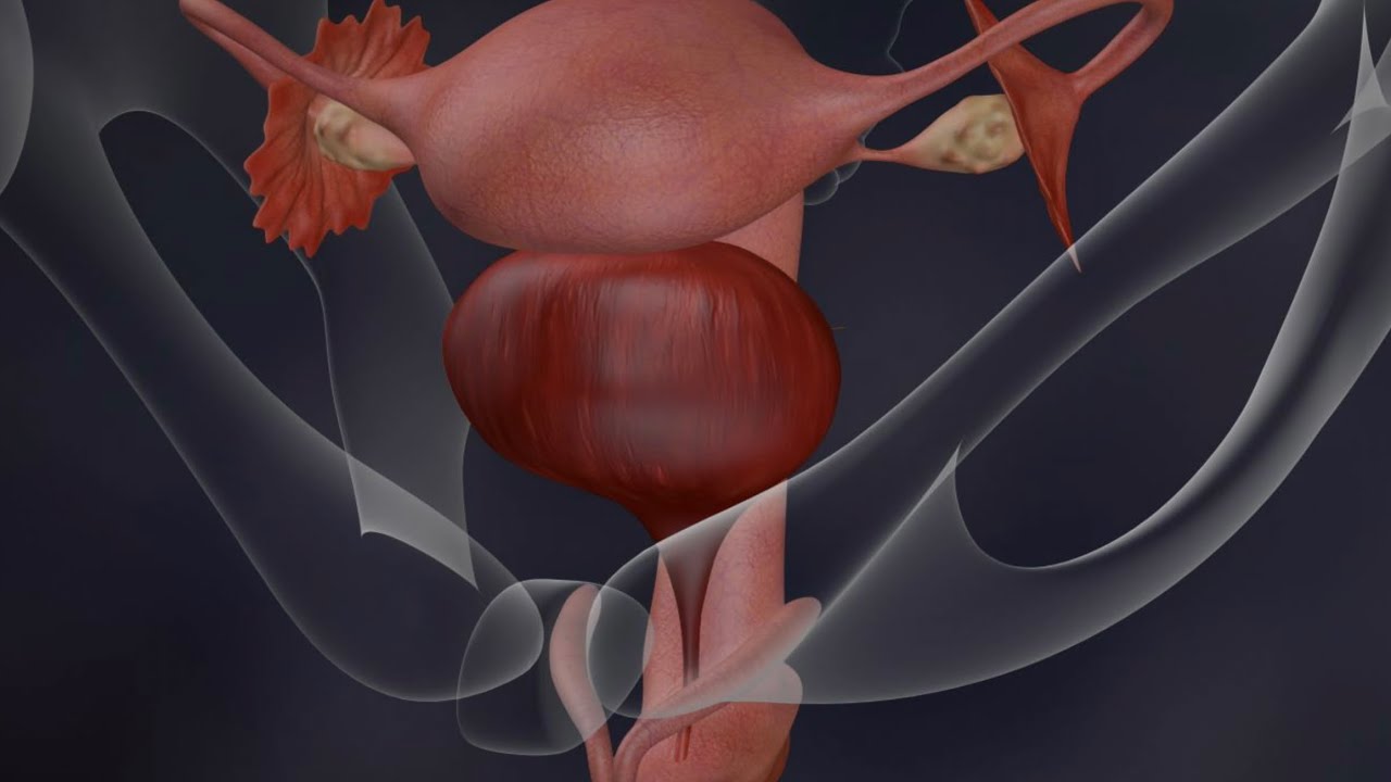 Миом болон аденомиоз 2-н ялгаа