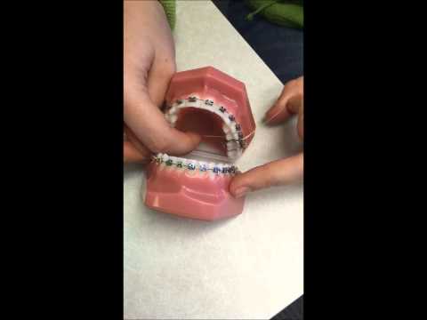 Orthodontic Care Kit