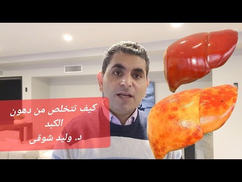 دهون الكبد وعلاجها وهل هى خطر وهل ممكن ان تؤدى لتليف الكبد