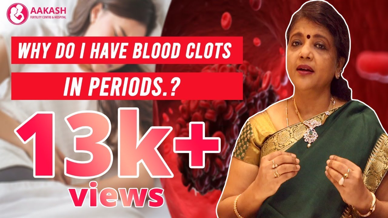 Are blood clots normal during a period?