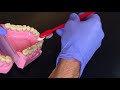 Diş Fırçalama Diş Fırçası Nasıl Kullanılmalı / Aykaçdiş Ortodonti İmplant Estetik Dr. Volkan AYKAÇ