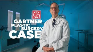 Dr. Gartner Plastic Surgery Case: Breast Augmentation Journey in Early 30s Post-Pregnancy