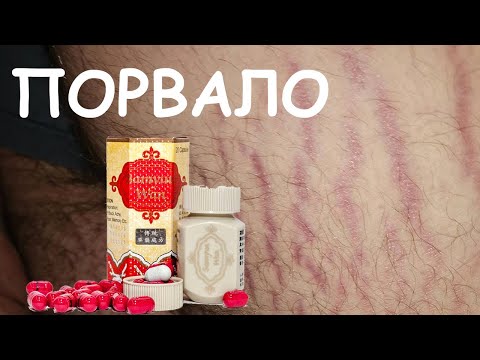 SAMYUN WAN - МАГИЧЕСКИЕ таблетки для набора веса личный отзыв + обзор на самюван