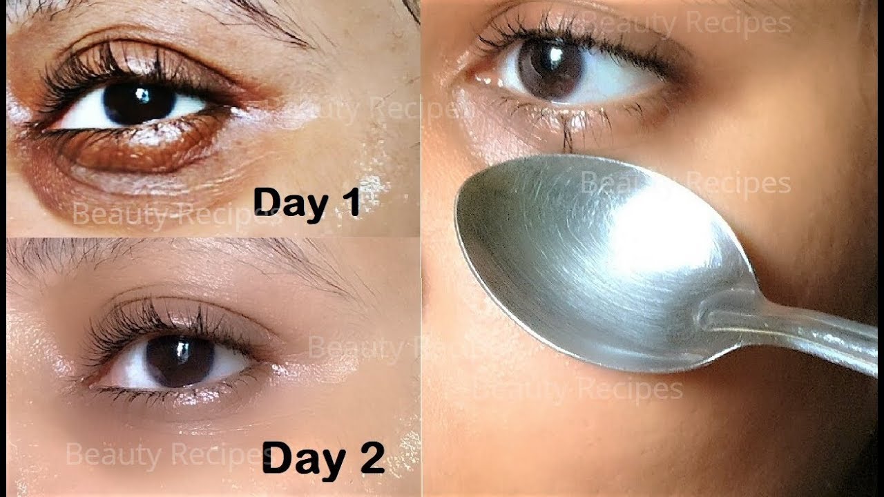 How to Remove Under Eye WRINKLES, Under Eye Bags, Puffy eyes & Dark Circles  in 1 Day with ice cubes - YouTube