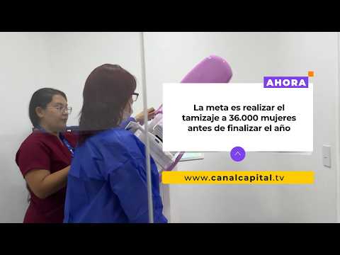 Two mammogram machines in Bogotá detected 35 breast cancer cases in one year | Health