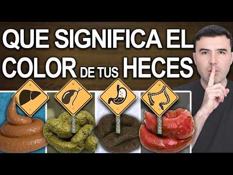 ¿Qué Dicen tus Heces? (INDICA CÁNCER) Colores, formas y moco que no debes ignorar