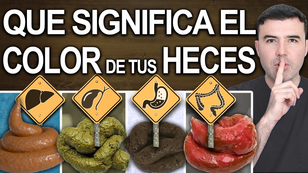 ¿Qué Dicen tus Heces? (INDICA CÁNCER) Colores, formas y moco que no debes ignorar