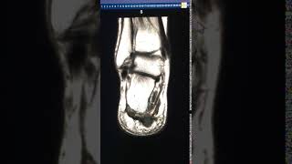IMG 0289