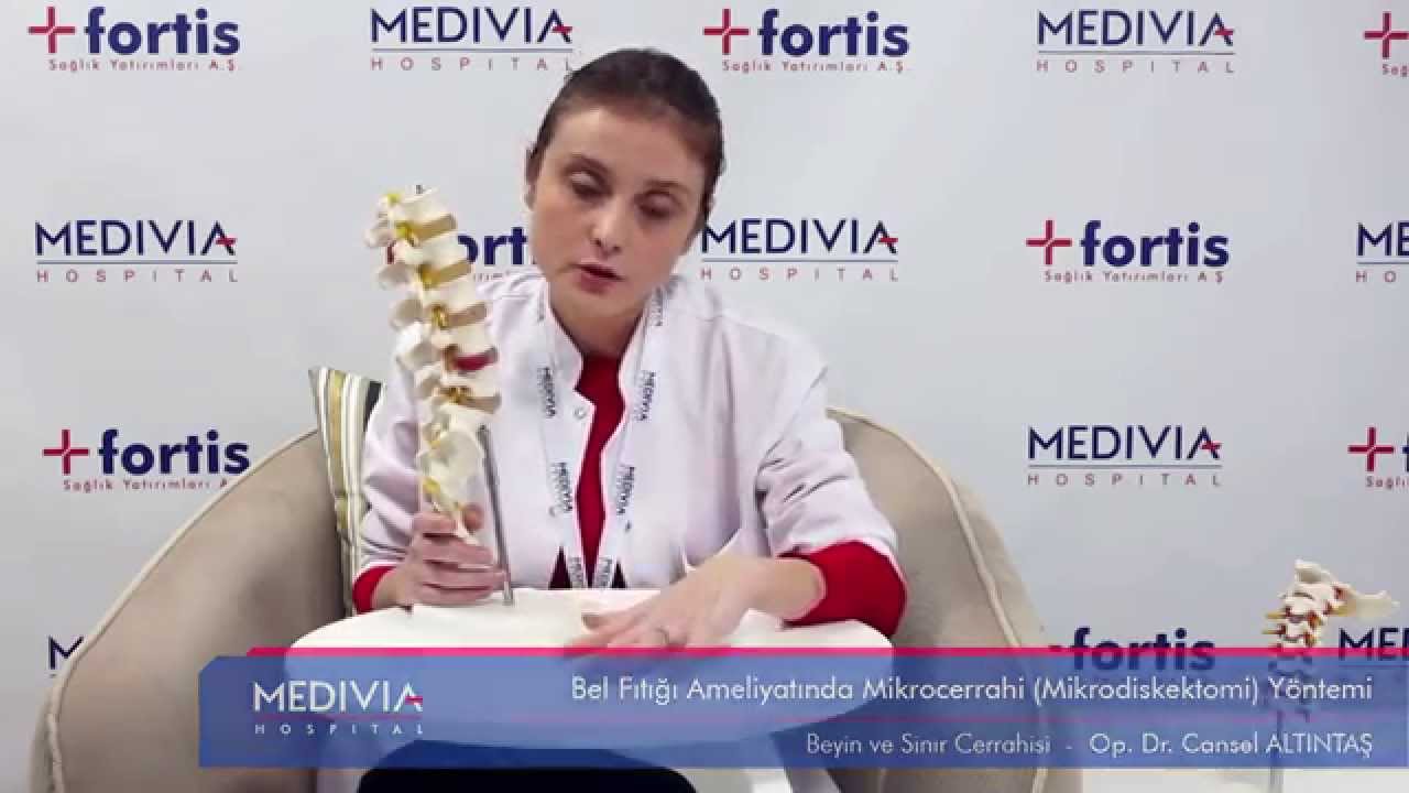 Bel Fıtığı Ameliyatında Mikrocerrahi (Mikrodiskektomi) Yöntemi