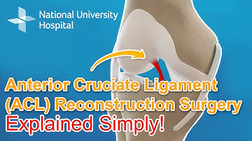 Anterior Cruciate Ligament (ACL) Reconstruction Surgery - Explained
