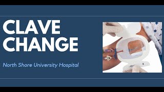 Changing Claves for Access Catheters
