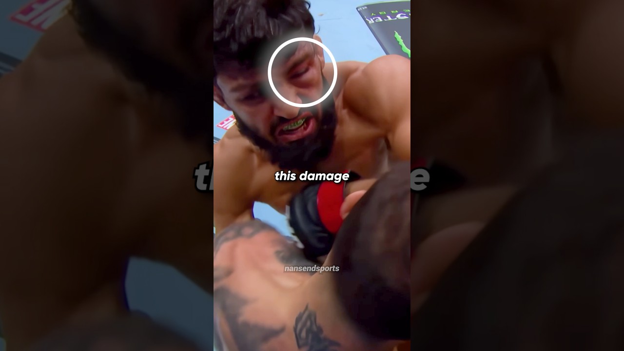 Nobody Noticed How this Happened 🤷‍♂️✅ #ufc