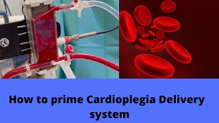 How to prime Cardioplegia Delivery system