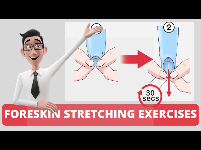 4 Phimosis (Tight Foreskin) Exercises: FIVE Foreskin stretching