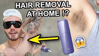 IPL HAIR REMOVAL AT HOME!😱 (with Ulike) - no longer need to shave!💗