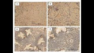 Tear ferning test clinical technique to evaluate the quality of the tear film; Patterns, How it work